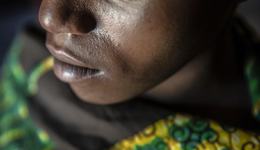 Stigma_Woman from DRC_War Child in Congo_180628