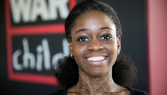 Michaela DePrince ambassadeur War Child-met logo_151103