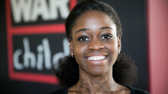 Michaela DePrince ambassadeur voor War Child